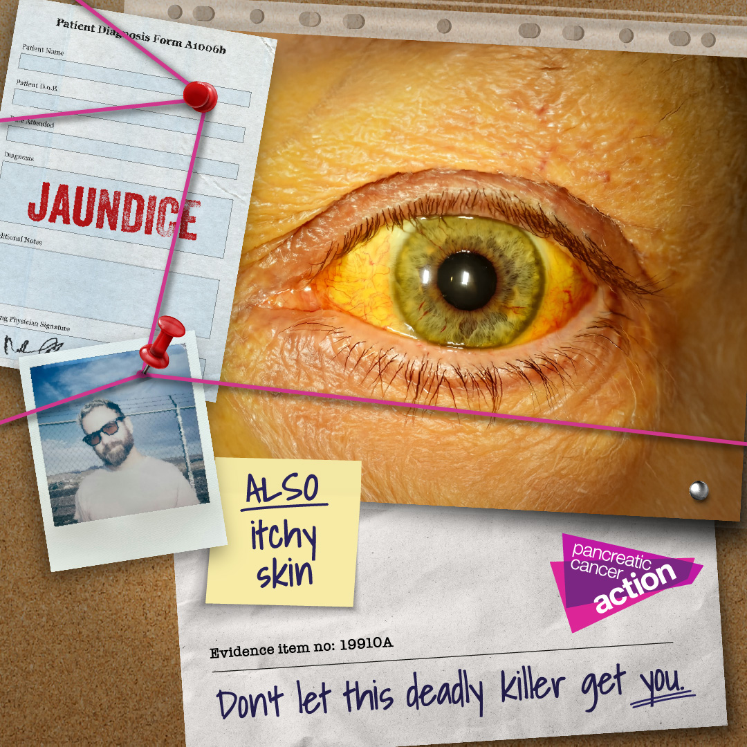 6051_03 PanCan 2025 Social static 1080x1080_jaundice.jpg